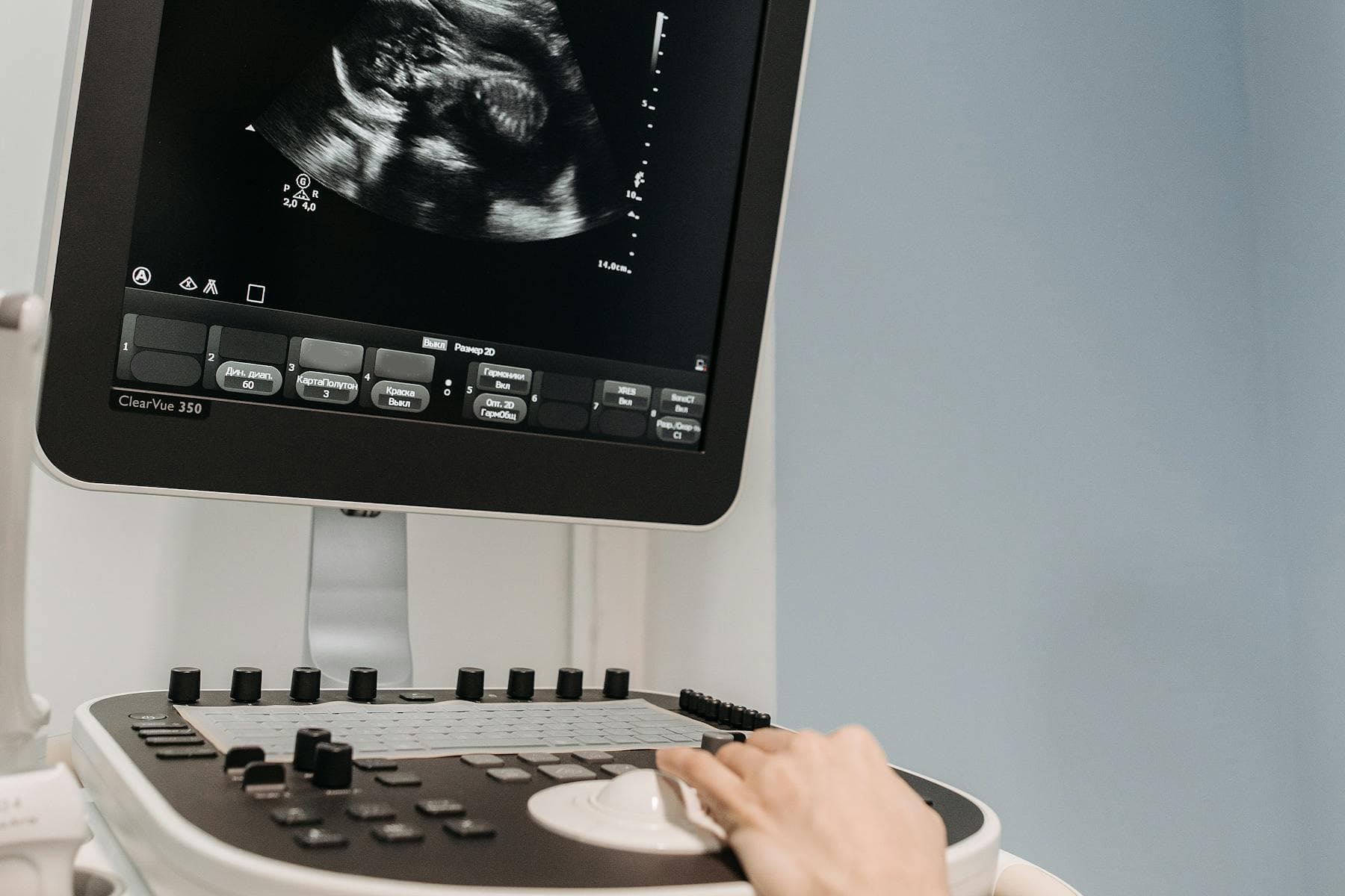 Stock photo representing colour Doppler imaging.